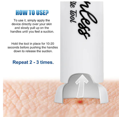 Itch Relief Suction Tool for Bug Bites